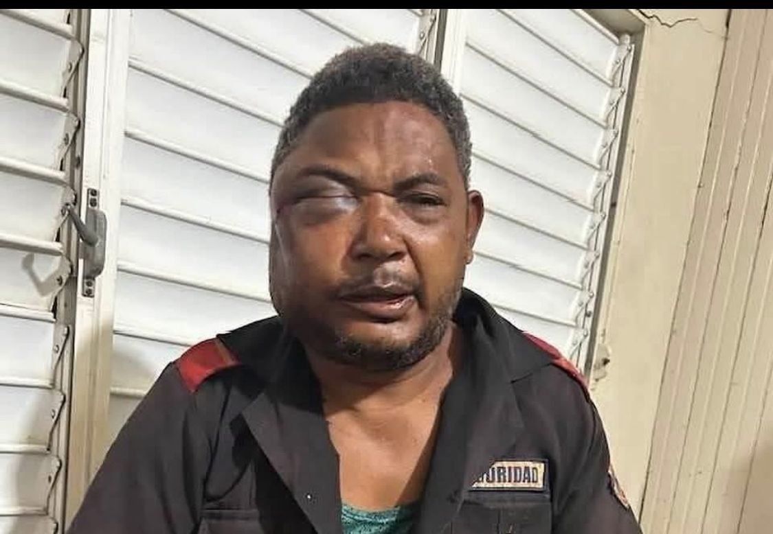 Seguridad de una empresa en Montecristi resultó herido tras ser víctima de atraco – El Nuevo Diario (República Dominicana)