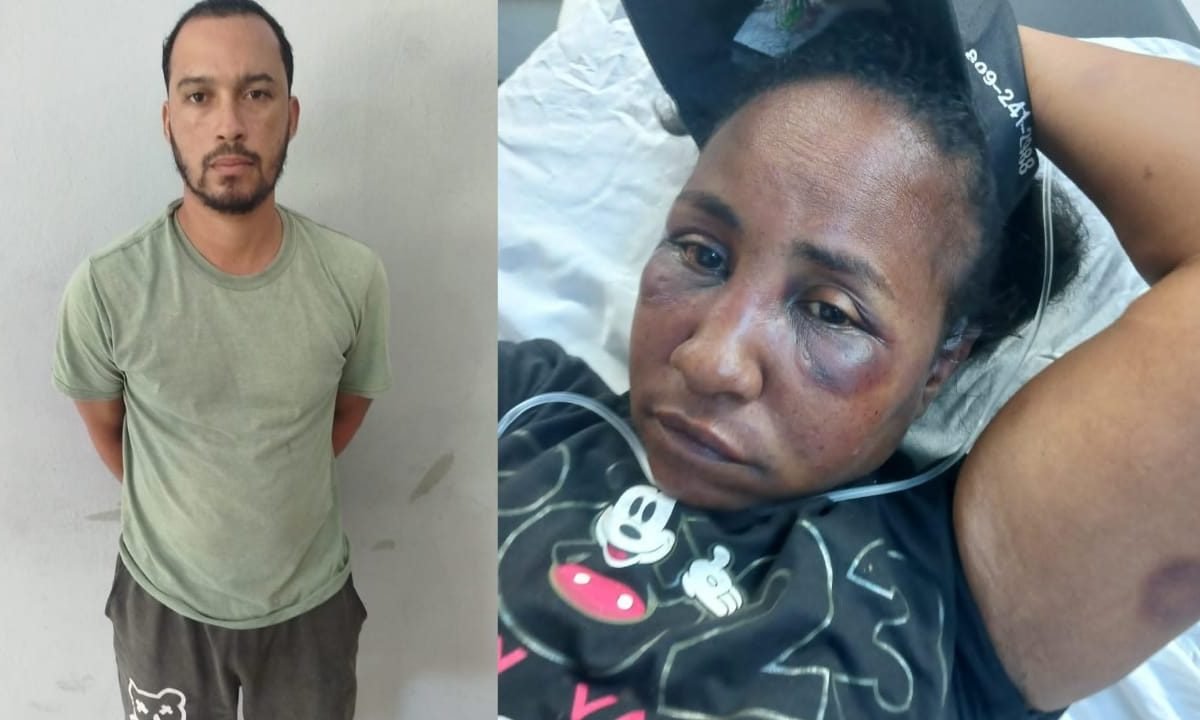 Apresan hombre que golpeó brutalmente mujer – El Nuevo Diario (República Dominicana)